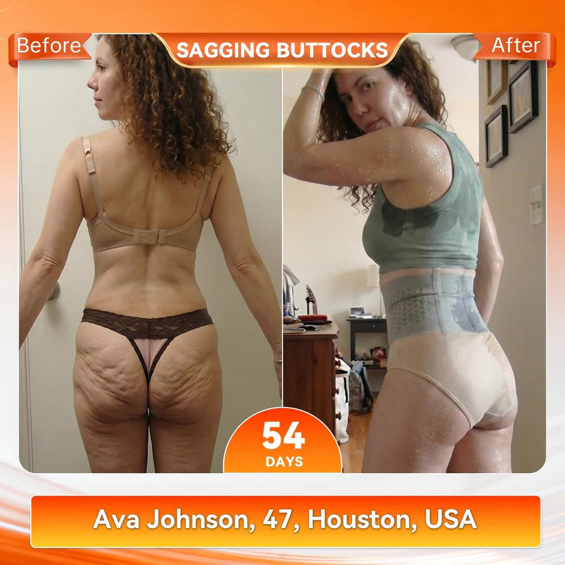 2026 Hemp and Coptisine Four-in-One Micro-Particulate Tightening Fat-Burning Shorts
